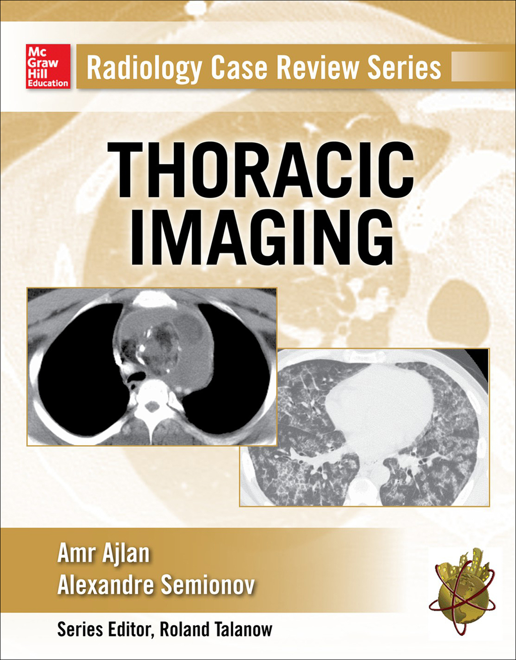 Radiology Case Review Series: Thoracic Imaging 1st Edition â€“ PDF/EPUB Version Downloadable