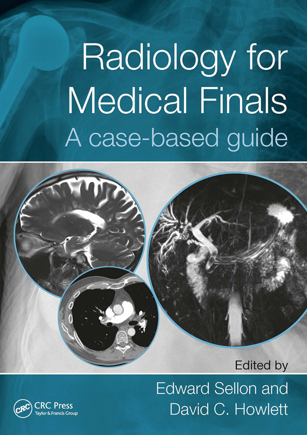 Radiology for Medical Finals A case-based guide 1st Edition â€“ PDF/EPUB Version Downloadable