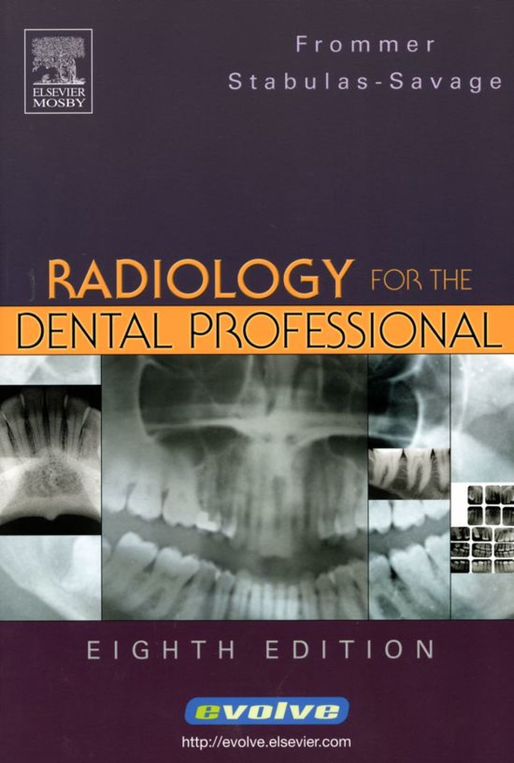 Radiology for the Dental Professional 8th Edition â€“ PDF/EPUB Version Downloadable