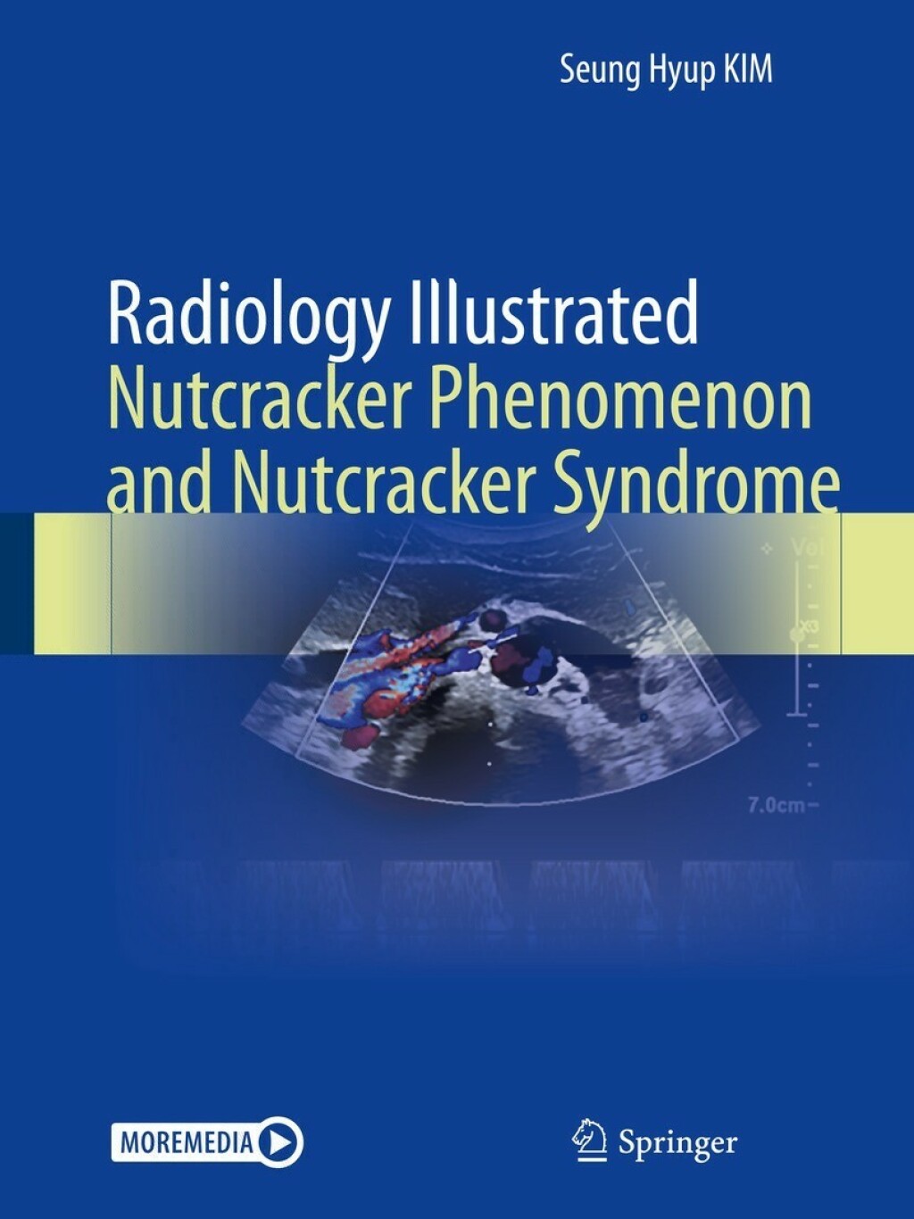Radiology Illustrated: Nutcracker Phenomenon and Nutcracker Syndrome  â€“ PDF/EPUB Version Downloadable
