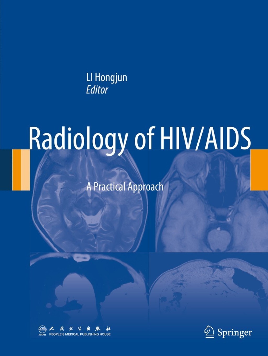 Radiology of HIV/AIDS A Practical Approach  â€“ PDF/EPUB Version Downloadable