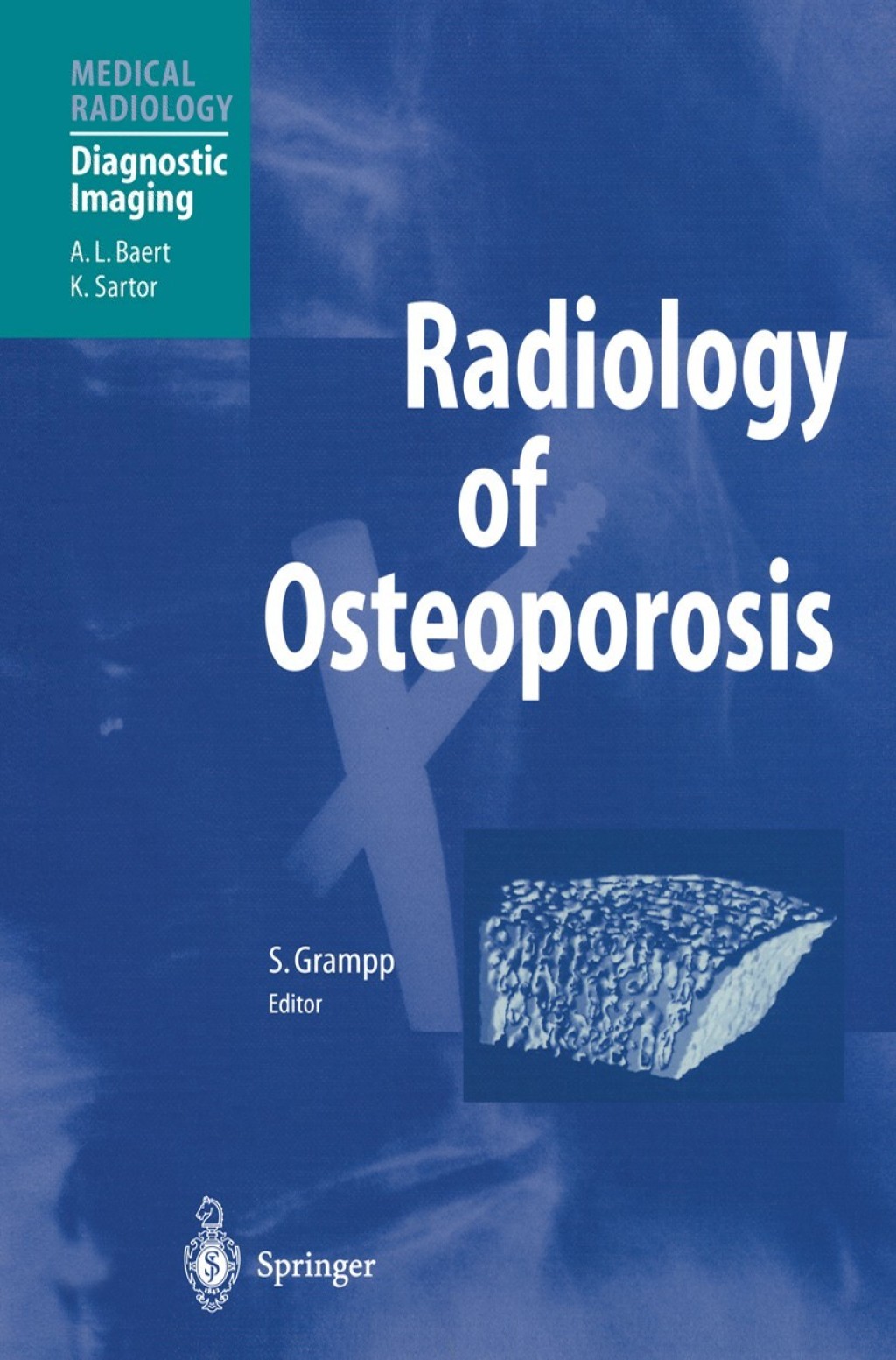 Radiology of Osteoporosis 1st Edition â€“ PDF/EPUB Version Downloadable