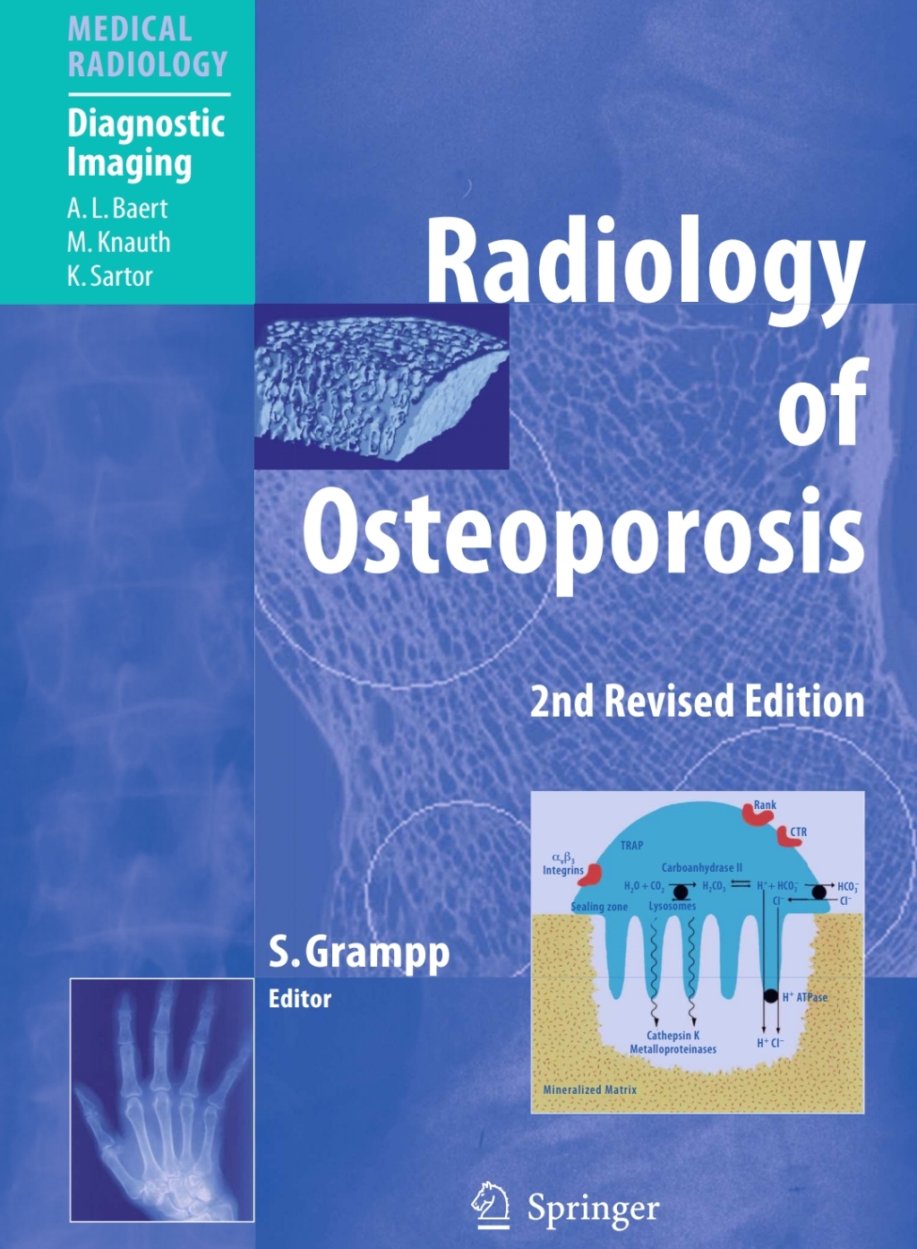 Radiology of Osteoporosis 2nd Edition â€“ PDF/EPUB Version Downloadable