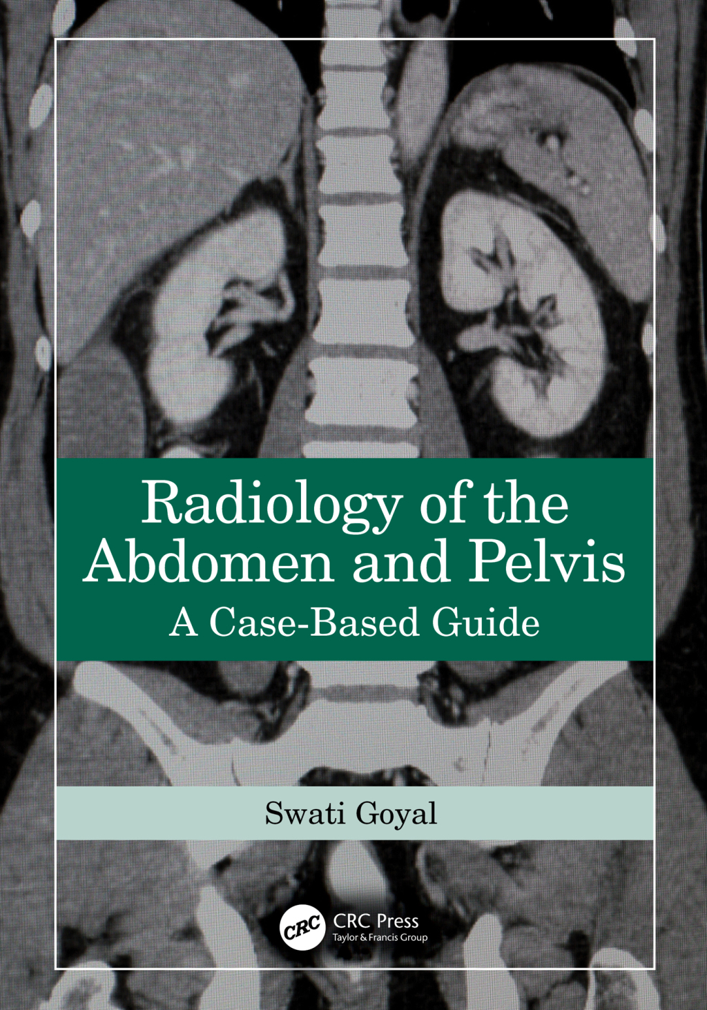Radiology of the Abdomen and Pelvis A Case-Based Guide 1st Edition â€“ PDF/EPUB Version Downloadable