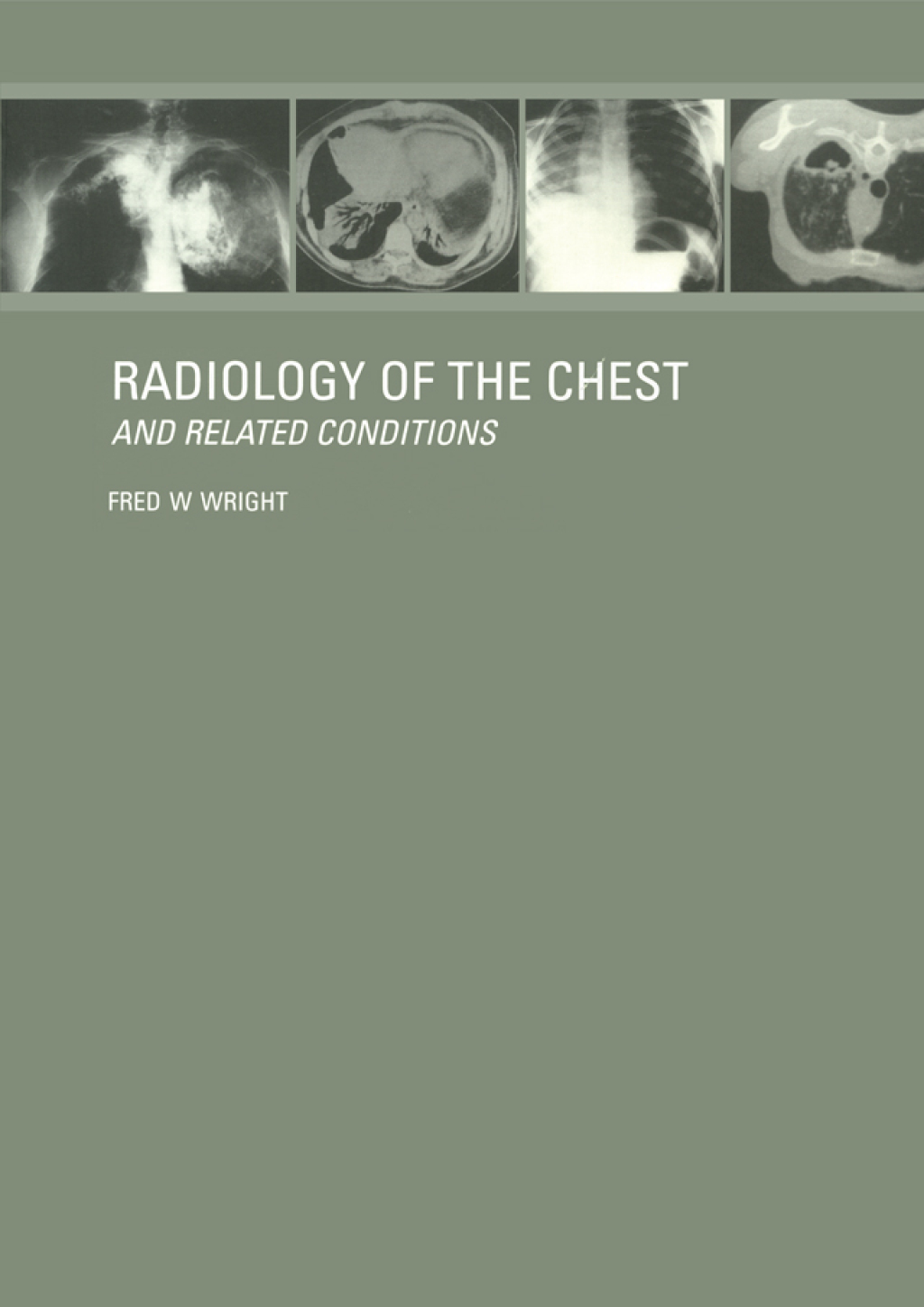 Radiology of the Chest and Related Conditions 1st Edition â€“ PDF/EPUB Version Downloadable