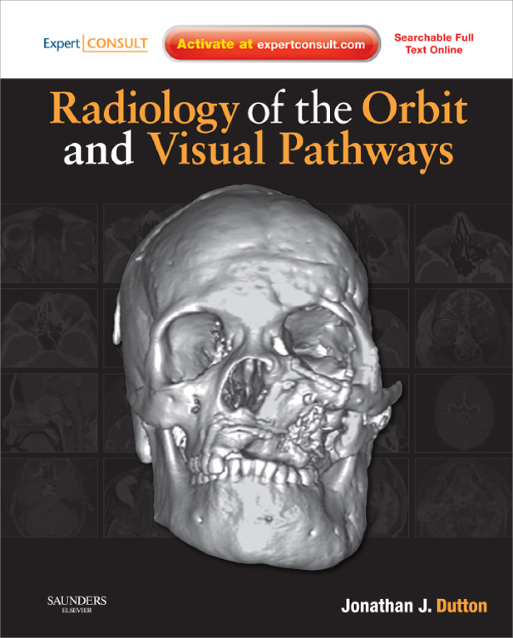Radiology of the Orbit and Visual Pathways E-Book 1st Edition â€“ PDF/EPUB Version Downloadable