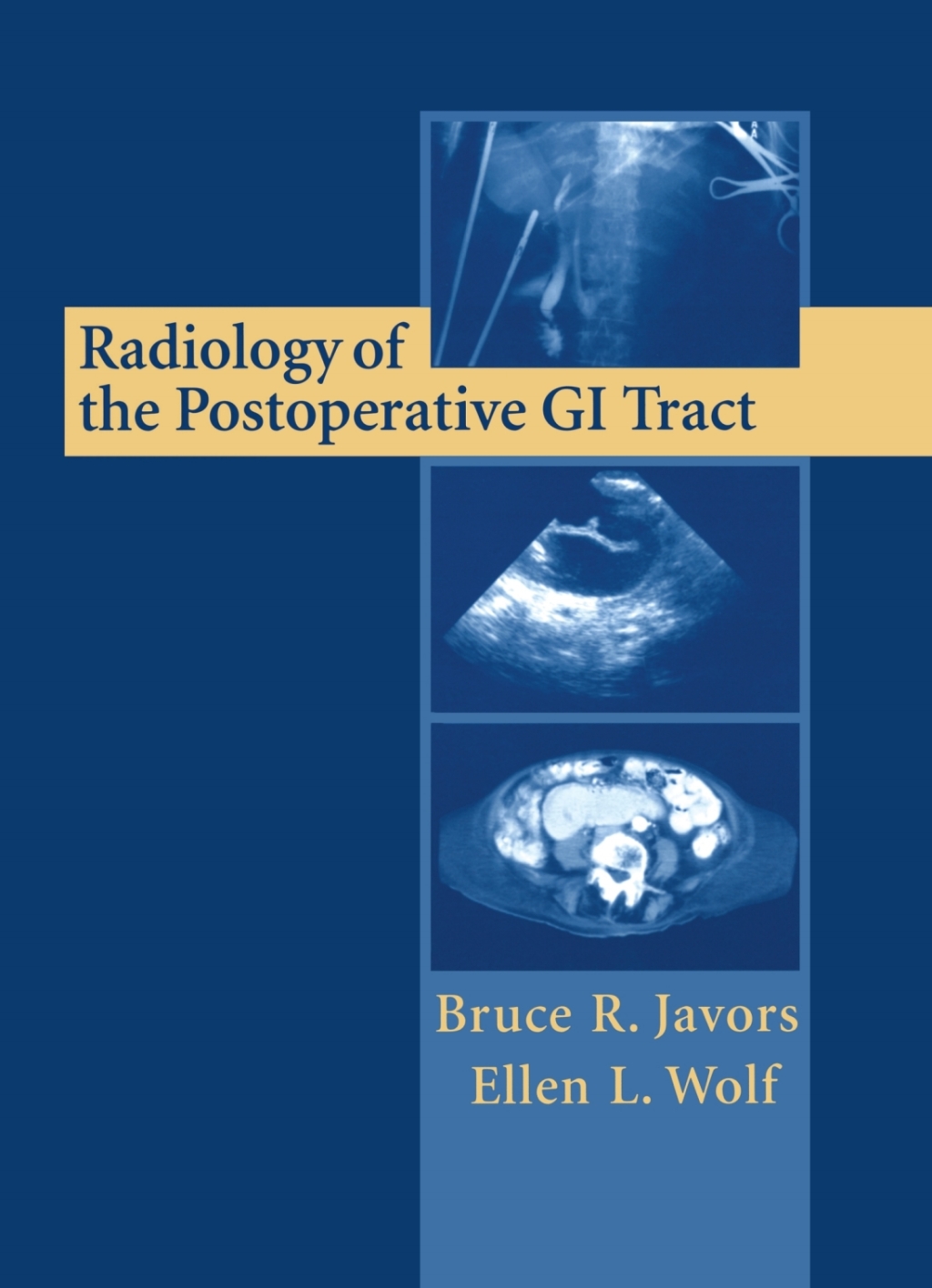 Radiology of the Postoperative GI Tract  â€“ PDF/EPUB Version Downloadable