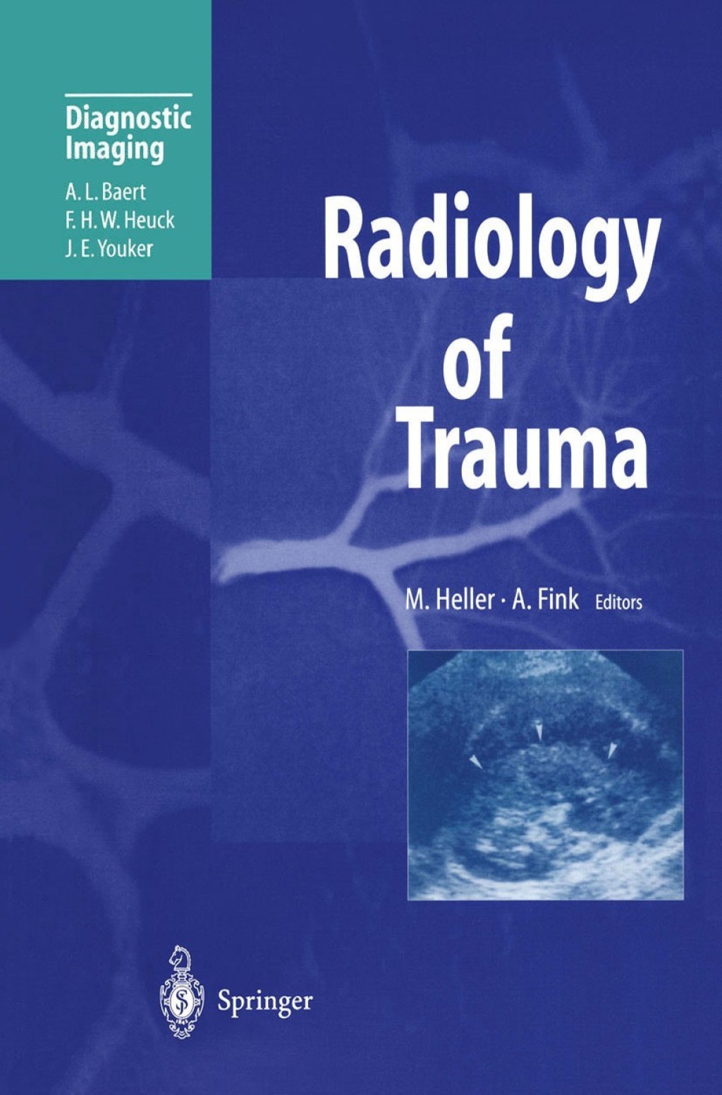 Radiology of Trauma 1st Edition â€“ PDF/EPUB Version Downloadable