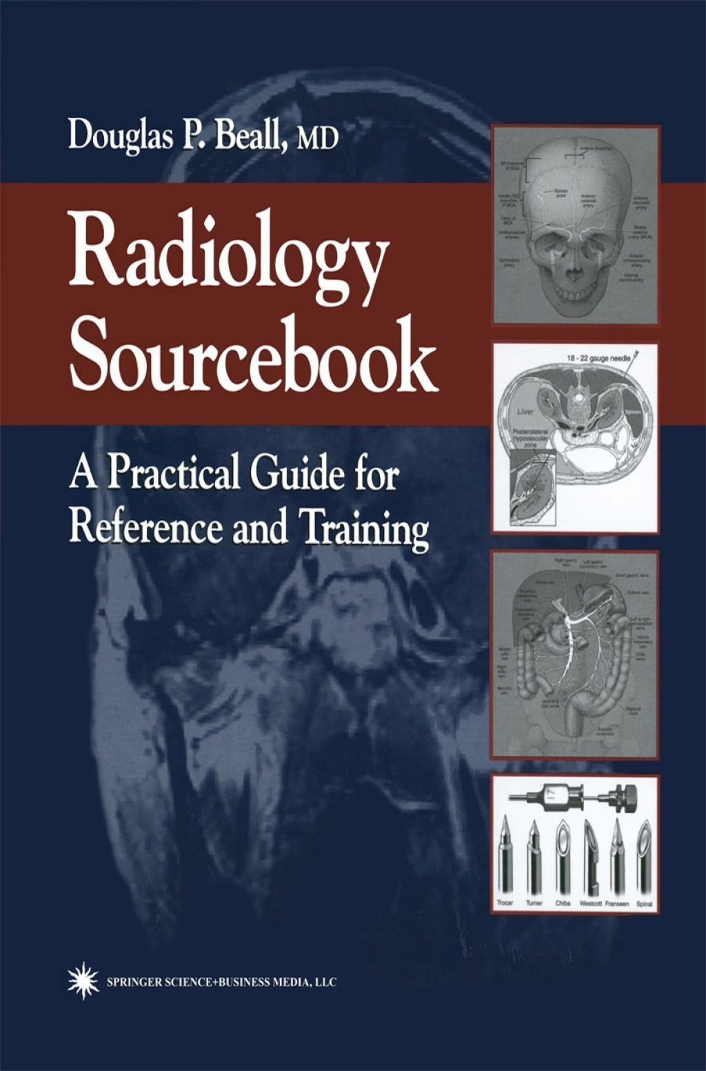 Radiology Sourcebook A Practical Guide for Reference and Training 1st Edition â€“ PDF/EPUB Version Downloadable