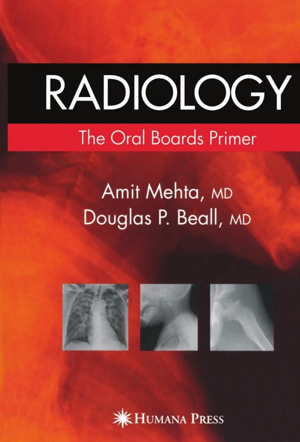 Radiology: The Oral Boards Primer 1st Edition â€“ PDF/EPUB Version Downloadable