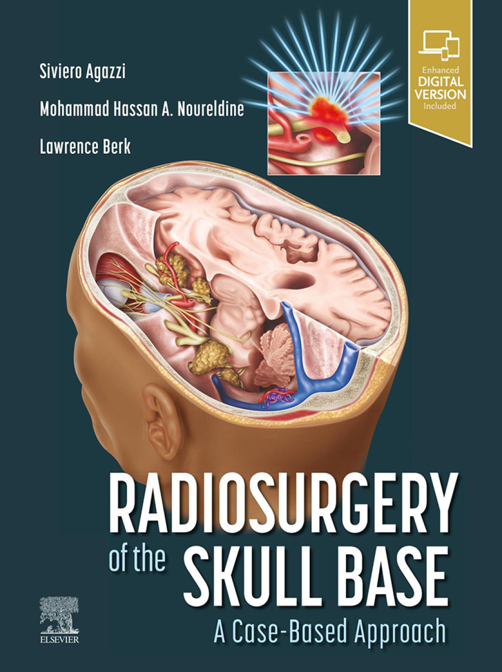 Radiosurgery of the Skull Base: A Case-Based Approach  â€“ PDF/EPUB Version Downloadable