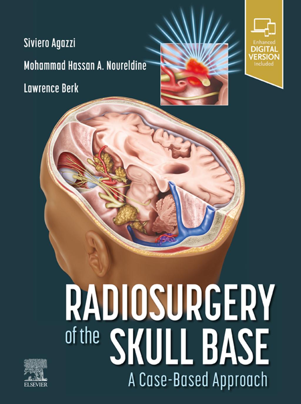 Radiosurgery of the Skull Base: A Case-Based Approach 1st Edition â€“ PDF/EPUB Version Downloadable