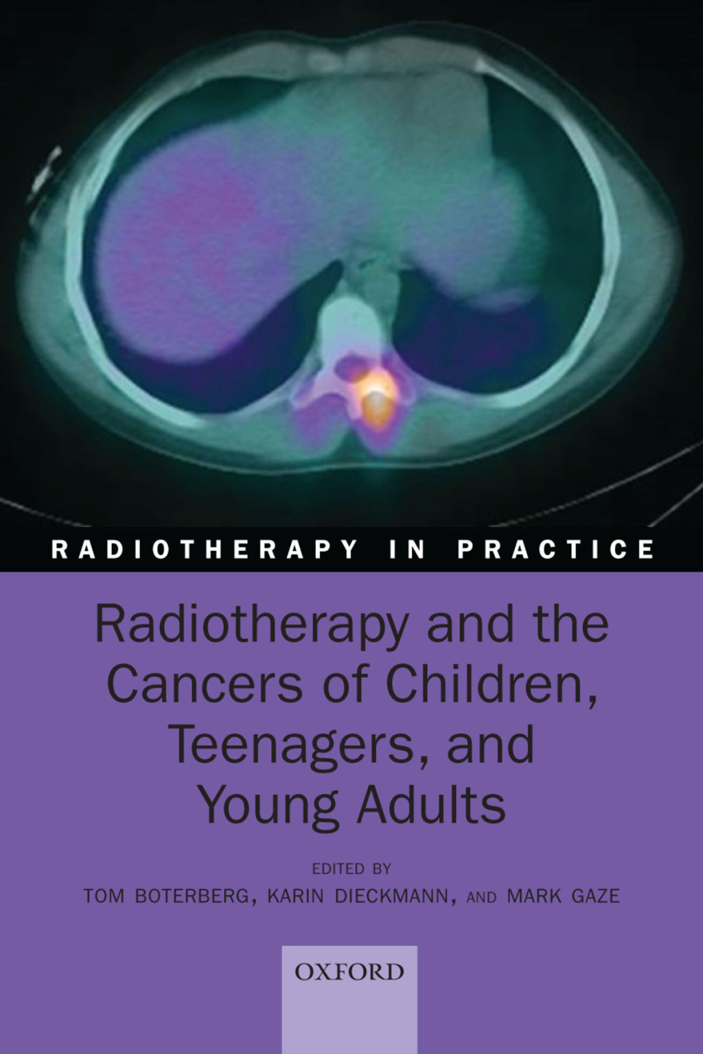 Radiotherapy and the Cancers of Children, Teenagers, and Young Adults 1st Edition â€“ PDF/EPUB Version Downloadable