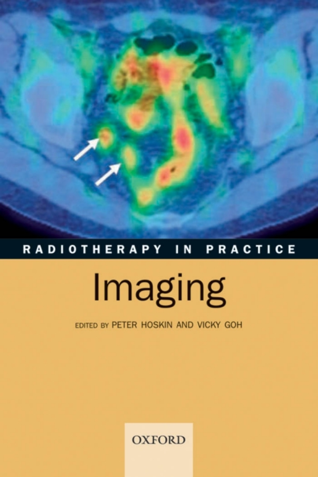 Radiotherapy in Practice - Imaging 1st Edition â€“ PDF/EPUB Version Downloadable