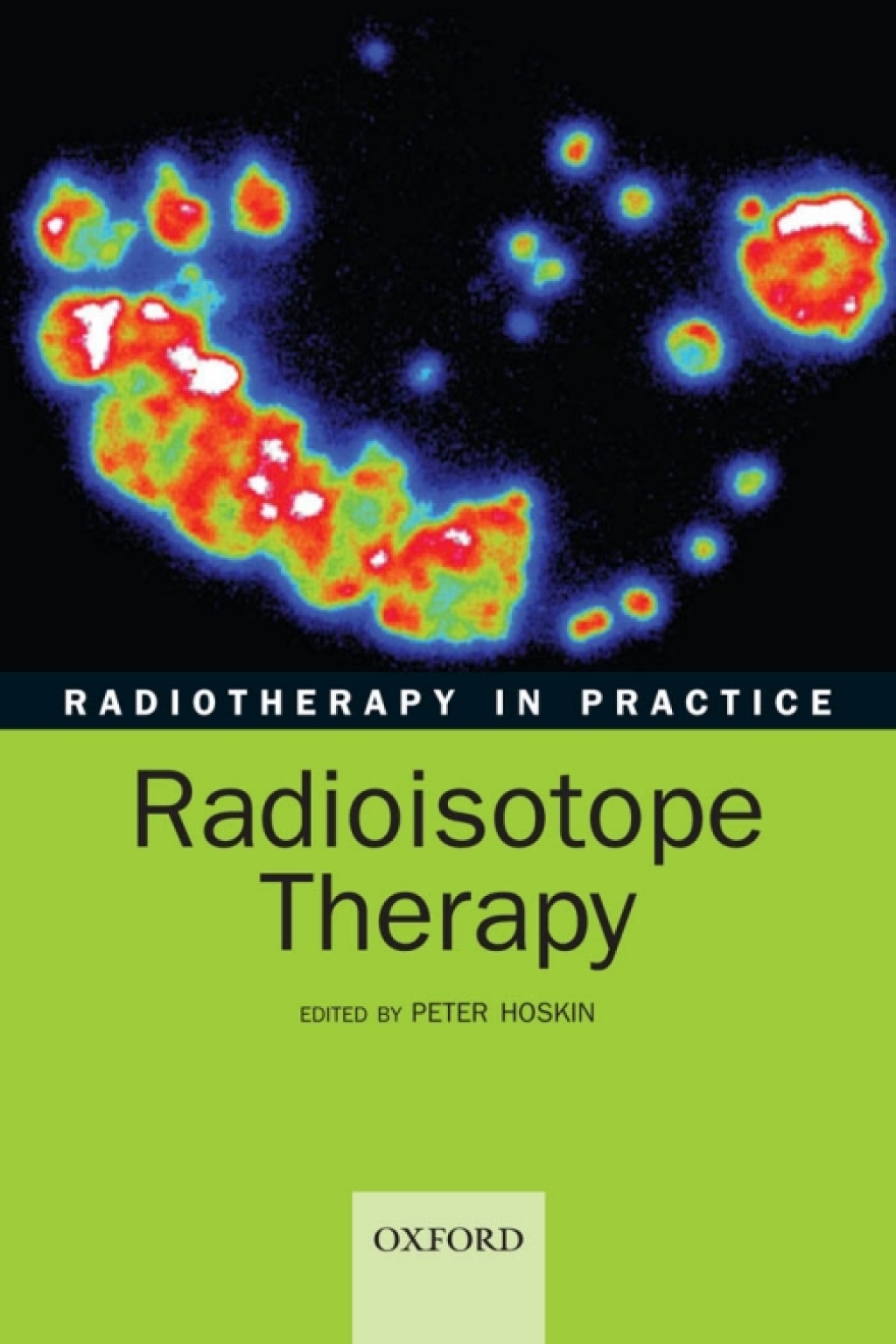 Radiotherapy in practice - radioisotope therapy 1st Edition â€“ PDF/EPUB Version Downloadable