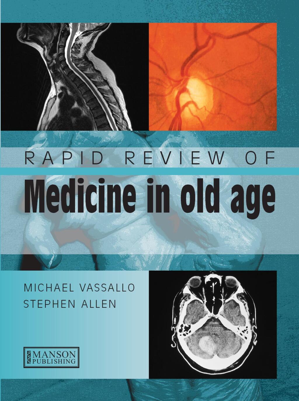 Rapid Review of Medicine in Old Age 1st Edition â€“ PDF/EPUB Version Downloadable