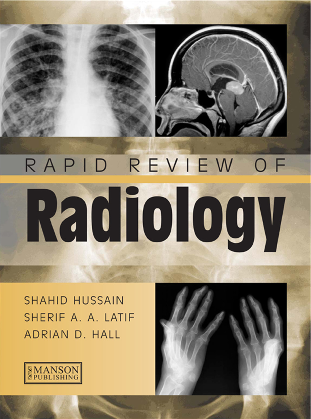 Rapid Review of Radiology 1st Edition â€“ PDF/EPUB Version Downloadable