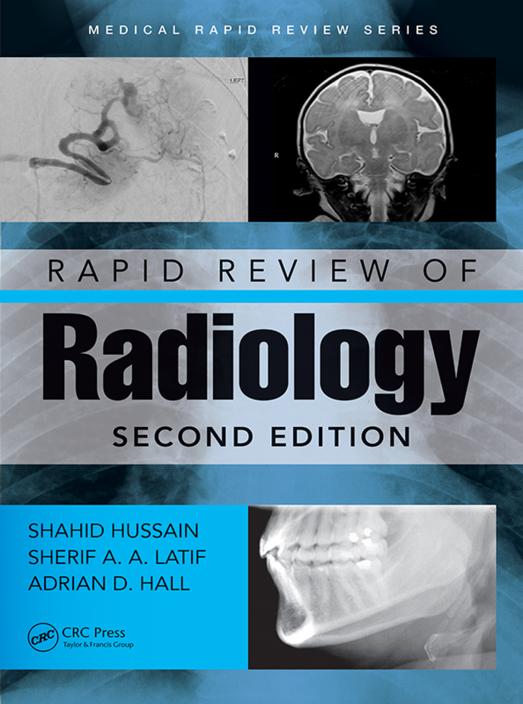 Rapid Review of Radiology 2nd Edition â€“ PDF/EPUB Version Downloadable