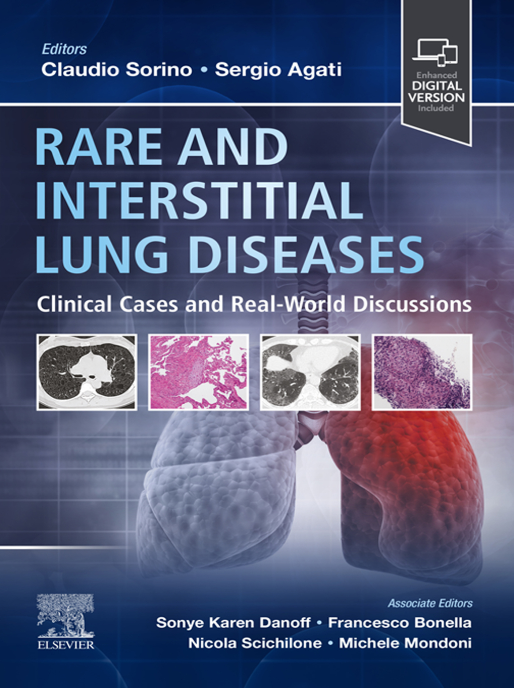Rare and Interstitial Lung Diseases Clinical Cases and Real-World Discussions 1st Edition â€“ PDF/EPUB Version Downloadable
