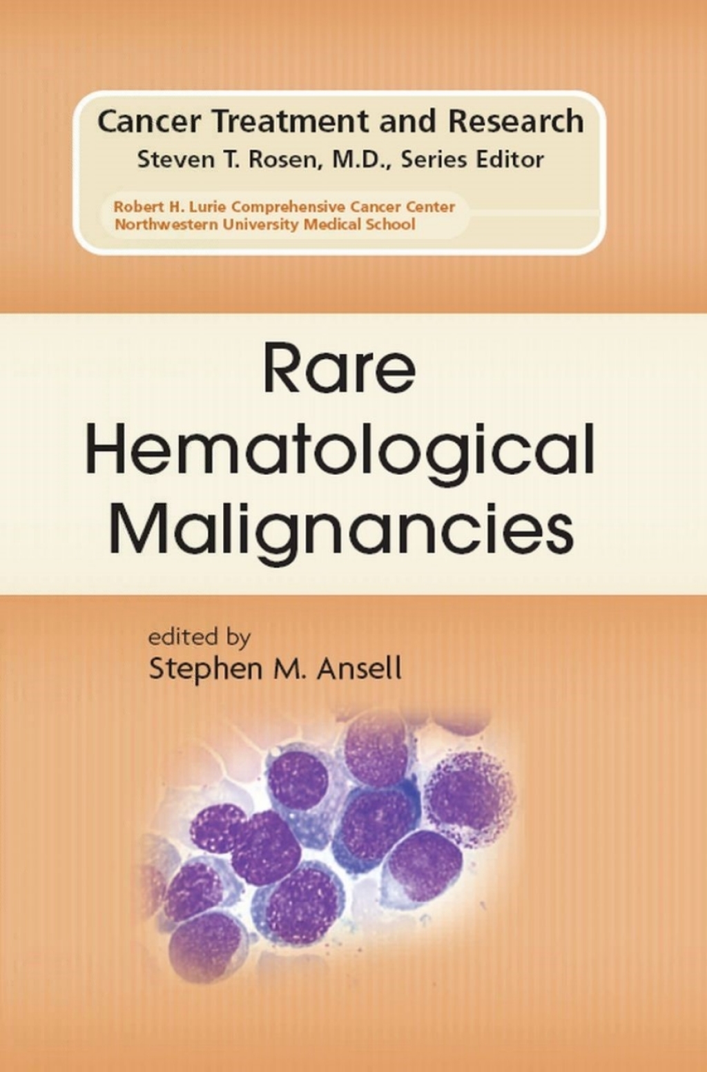 Rare Hematological Malignancies 1st Edition â€“ PDF/EPUB Version Downloadable