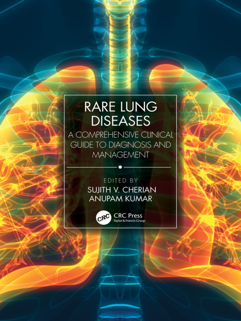Rare Lung Diseases A Comprehensive Clinical Guide to Diagnosis and Management 1st Edition â€“ PDF/EPUB Version Downloadable