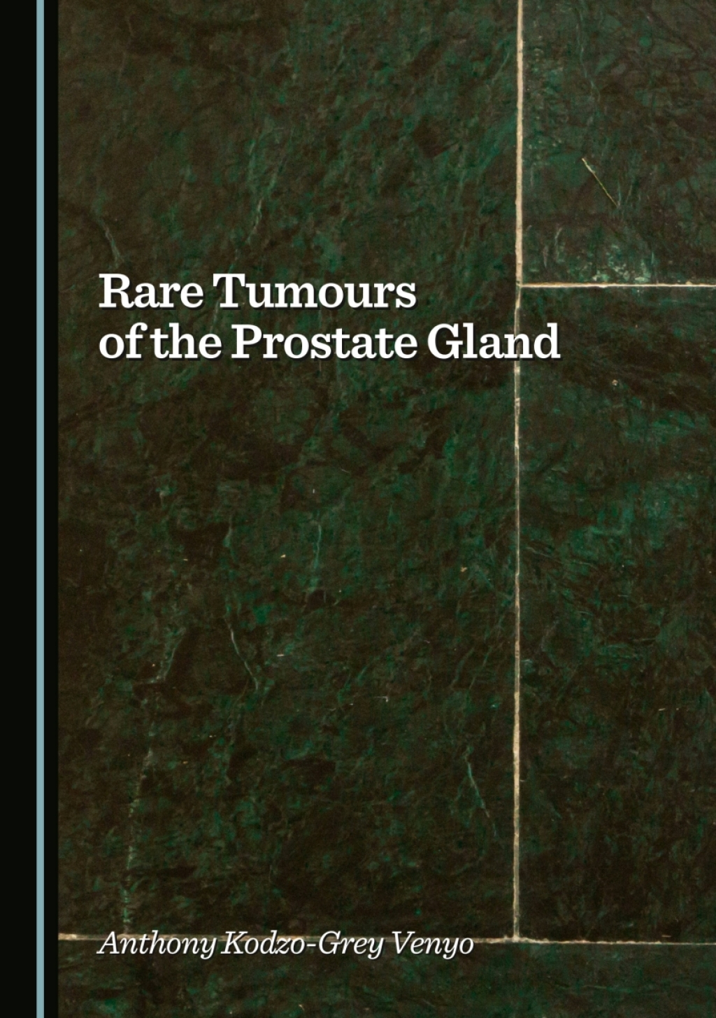 Rare Tumours of the Prostate Gland 1st Edition â€“ PDF/EPUB Version Downloadable