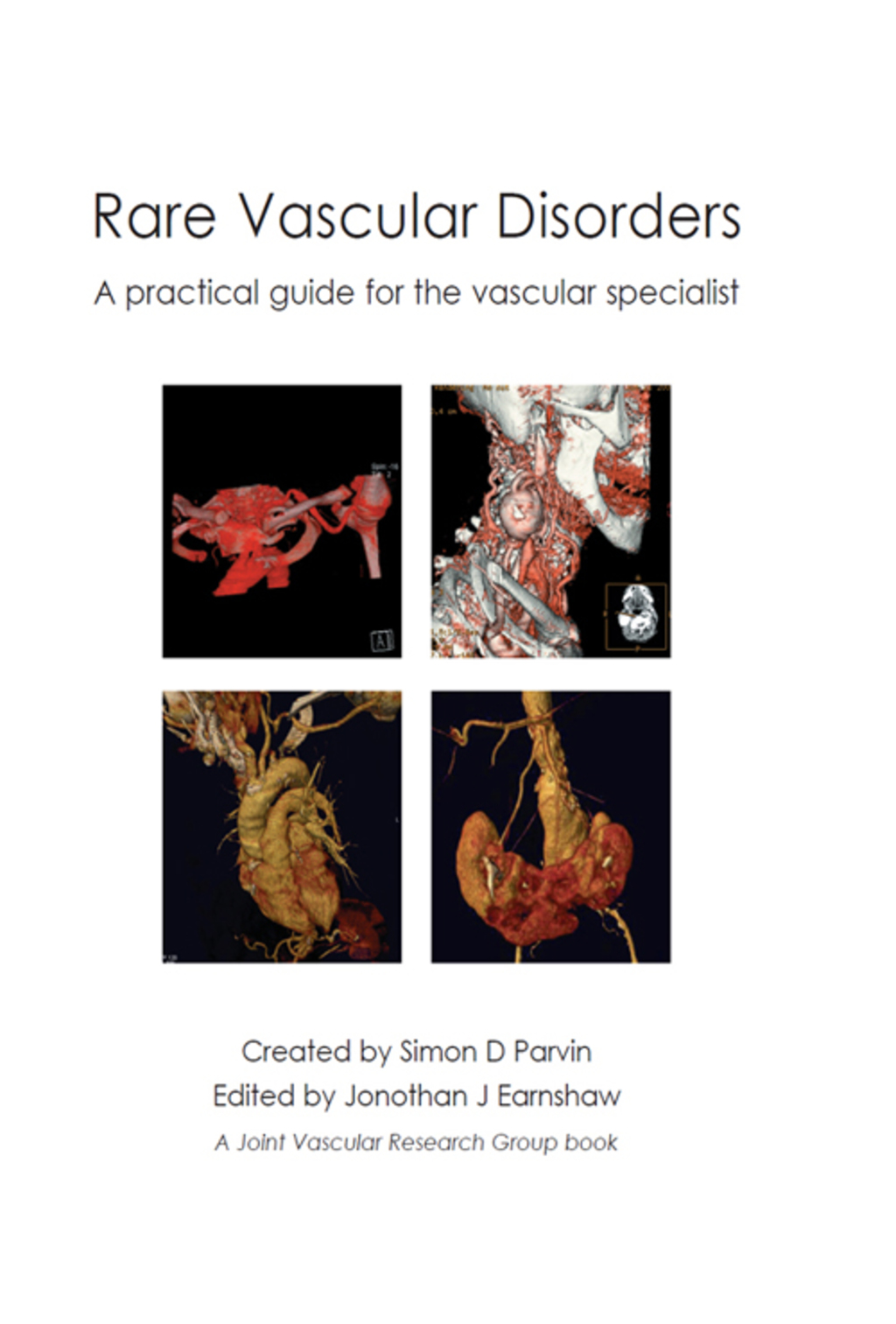 Rare Vascular Disorders 1st Edition â€“ PDF/EPUB Version Downloadable