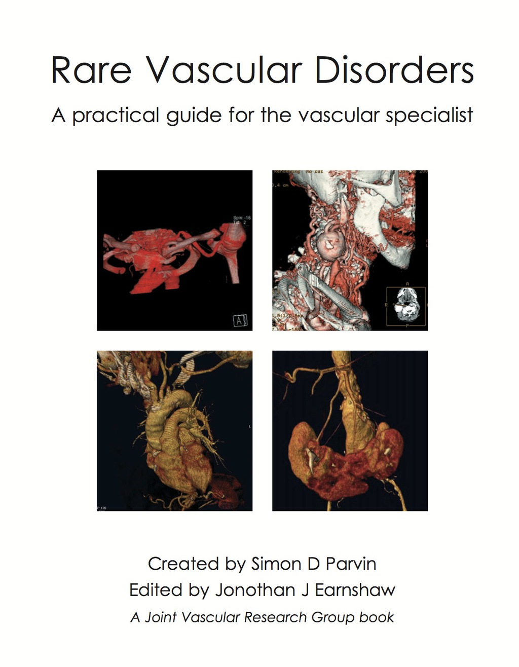 Rare Vascular Disorders 1st Edition â€“ PDF/EPUB Version Downloadable