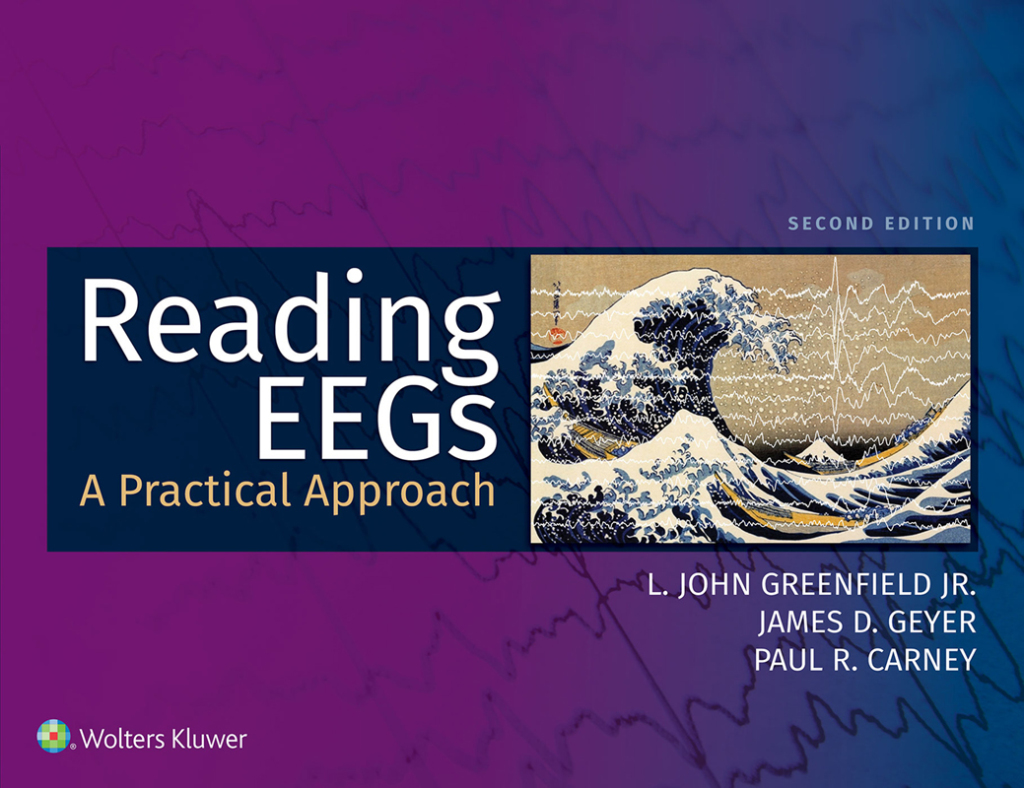 Reading EEGs: A Practical Approach 2nd Edition â€“ PDF/EPUB Version Downloadable