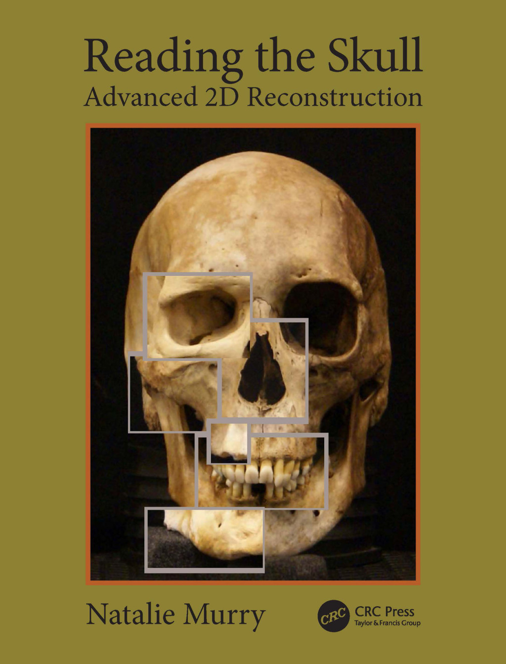 Reading the Skull Advanced 2D Reconstruction 1st Edition â€“ PDF/EPUB Version Downloadable