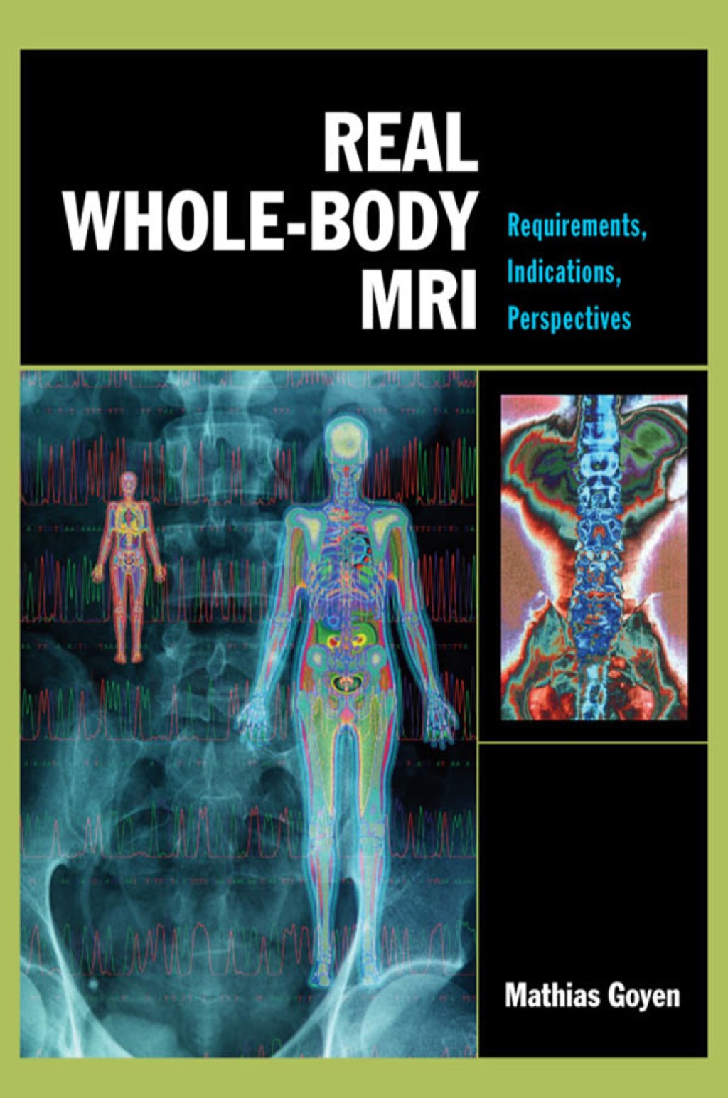 Real Whole-Body MRI: Requirements, Indications, Perspectives Requirements, Indications, Perspectives 1st Edition â€“ PDF/EPUB Version Downloadable