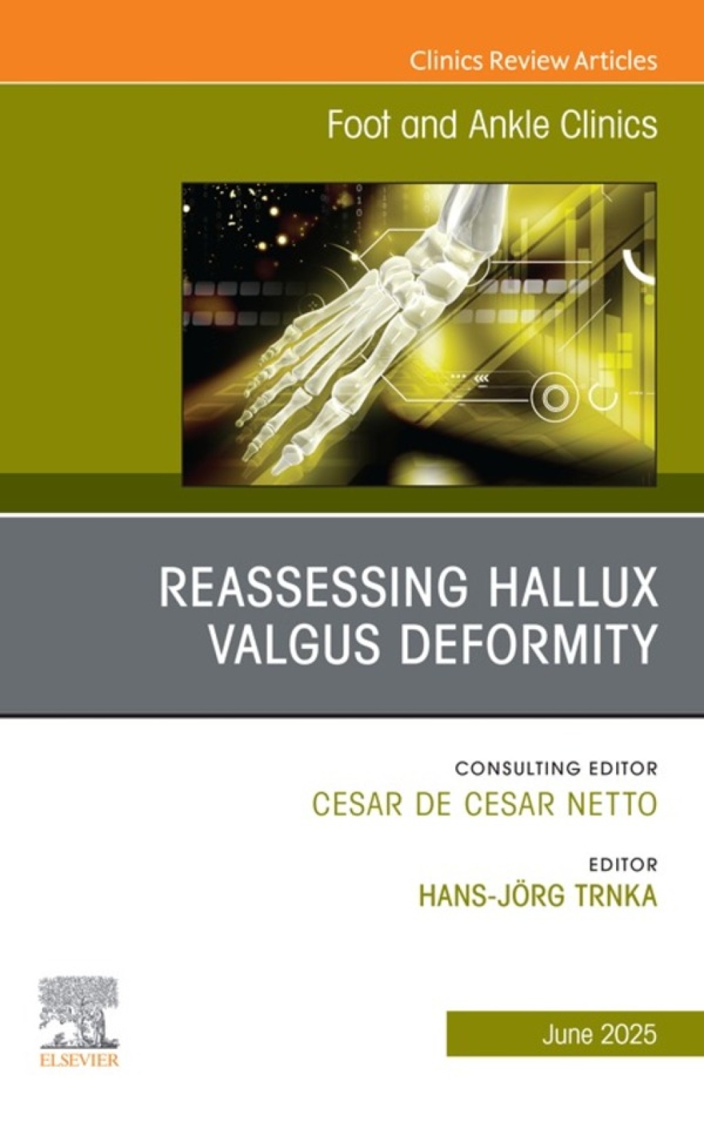 Reassessing Hallux Valgus Deformity, An issue of Foot and Ankle Clinics of North America  â€“ PDF/EPUB Version Downloadable
