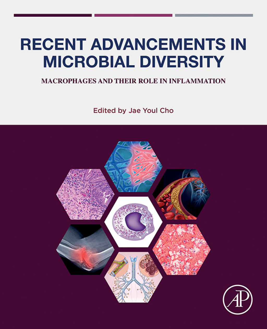 Recent Advancements in Microbial Diversity Macrophages and their Role in Inflammation  â€“ PDF/EPUB Version Downloadable