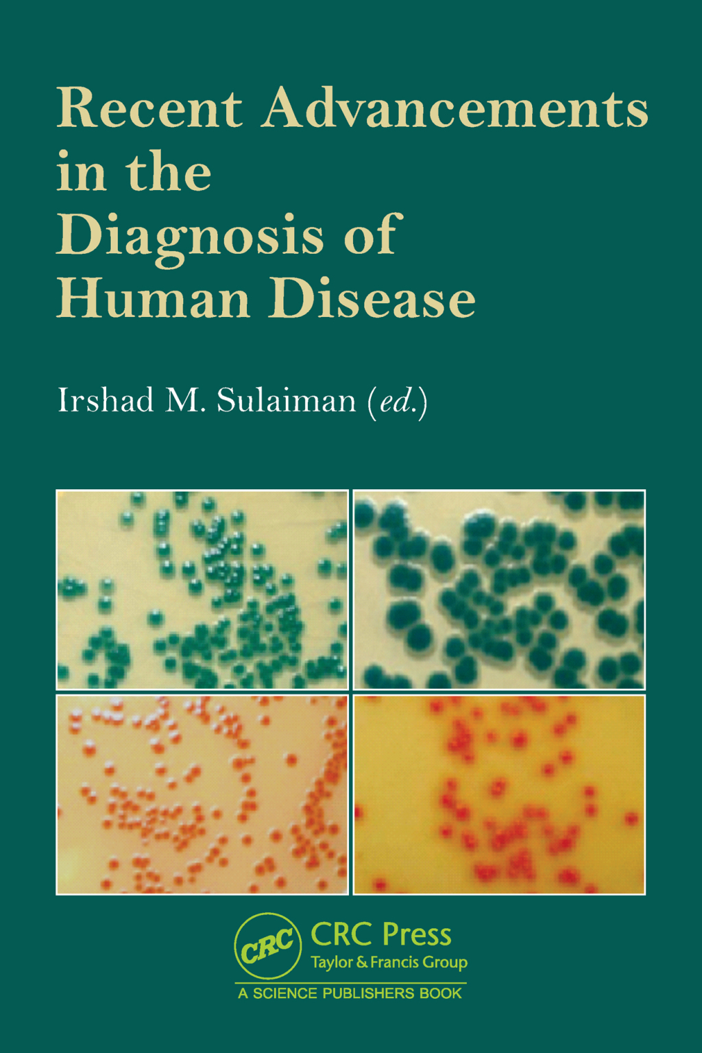 Recent Advancements in the Diagnosis of Human Disease 1st Edition â€“ PDF/EPUB Version Downloadable