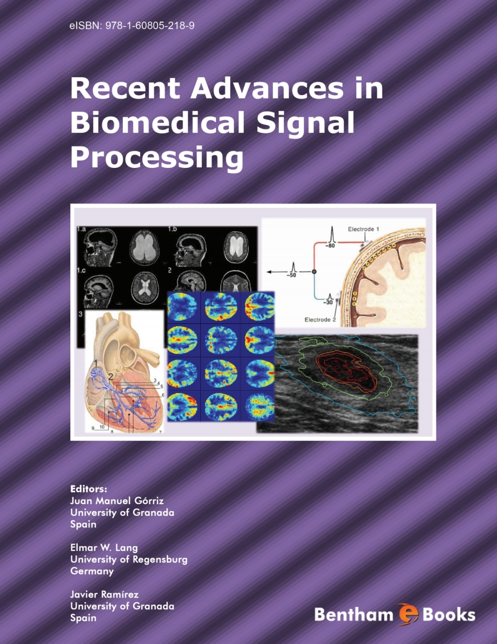 Recent Advances in Biomedical Signal Processing 1st Edition â€“ PDF/EPUB Version Downloadable