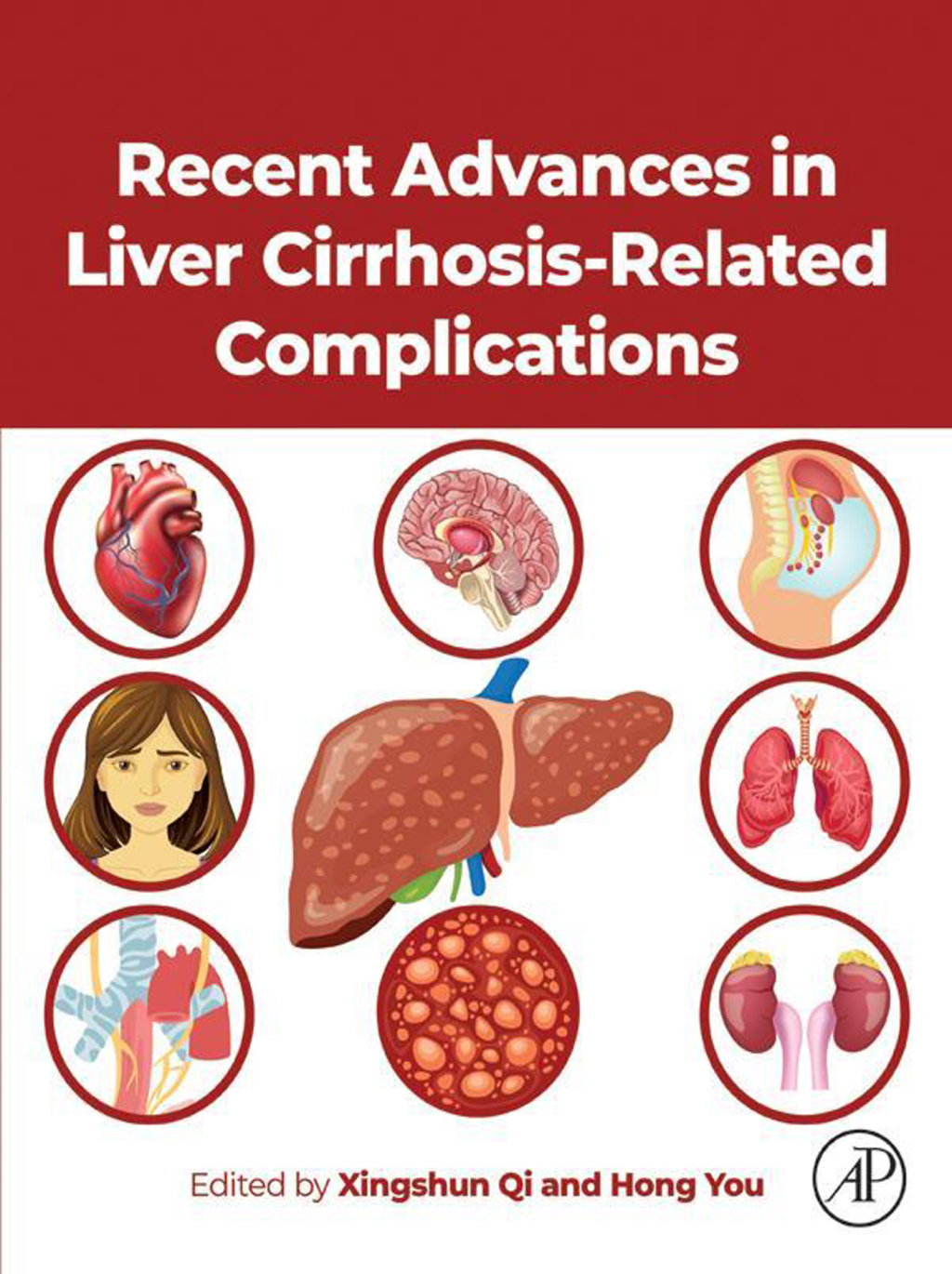 Recent Advances in Liver Cirrhosis Related Complications  â€“ PDF/EPUB Version Downloadable