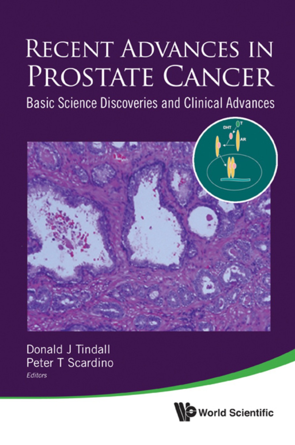 RECENT ADVANCES IN PROSTATE CANCER Basic Science Discoveries and Clinical Advances  â€“ PDF/EPUB Version Downloadable