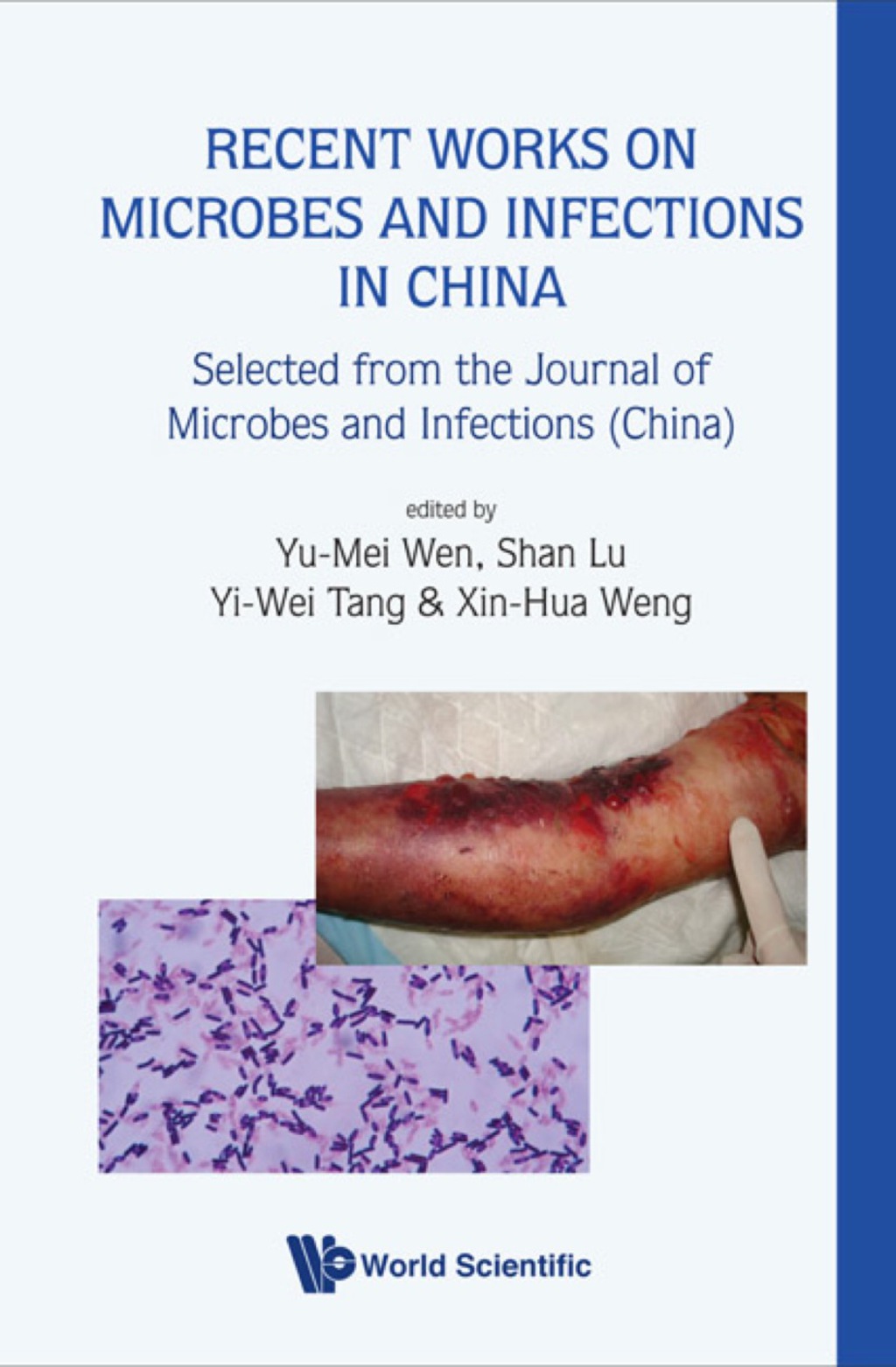 Recent Works On Microbes And Infections In China: Selected From The Journal Of Microbes And Infections (China)  â€“ PDF/EPUB Version Downloadable