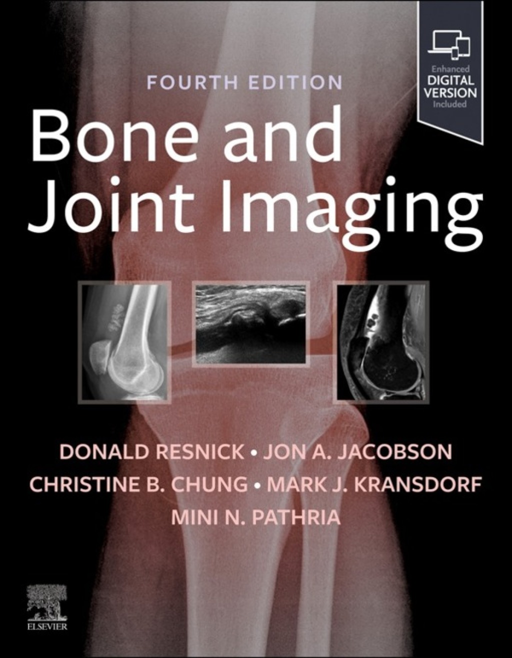 Resnick's Bone and Joint Imaging 4th Edition â€“ PDF/EPUB Version Downloadable
