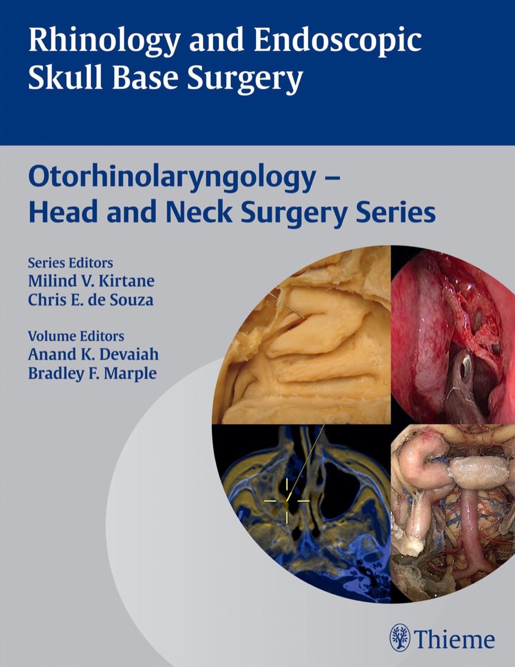 Rhinology and Endoscopic Skull Base Surgery 1st Edition â€“ PDF/EPUB ...