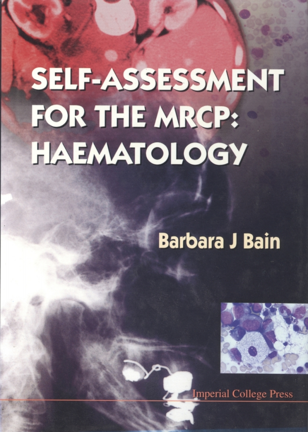 Self-Assessment for the MRCP: Haematology - (PDF/EPUB Version)