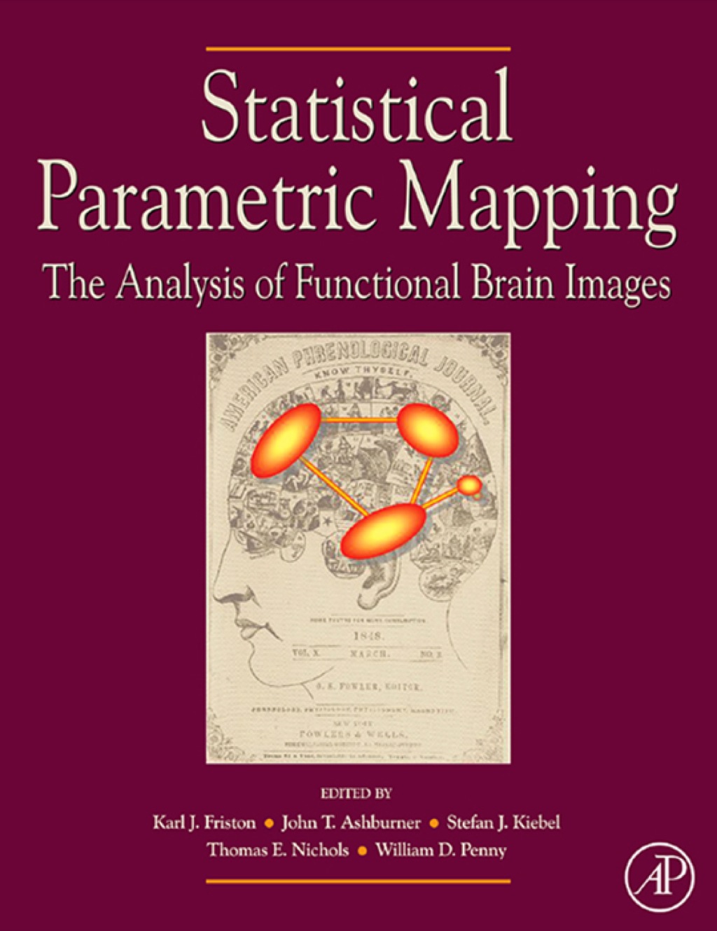 Statistical Parametric Mapping: The Analysis of Functional Brain Images ...