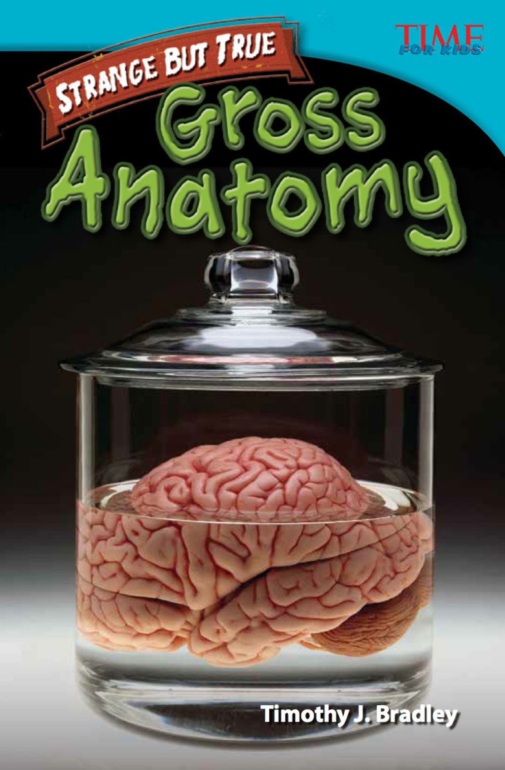 Strange but True: Gross Anatomy 2nd Edition - (PDF/EPUB Version)