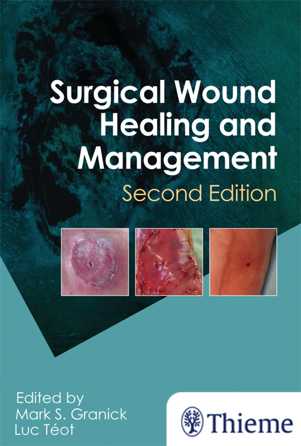 Surgical Wound Healing and Management 2nd Edition â€“ PDF/EPUB Version ...