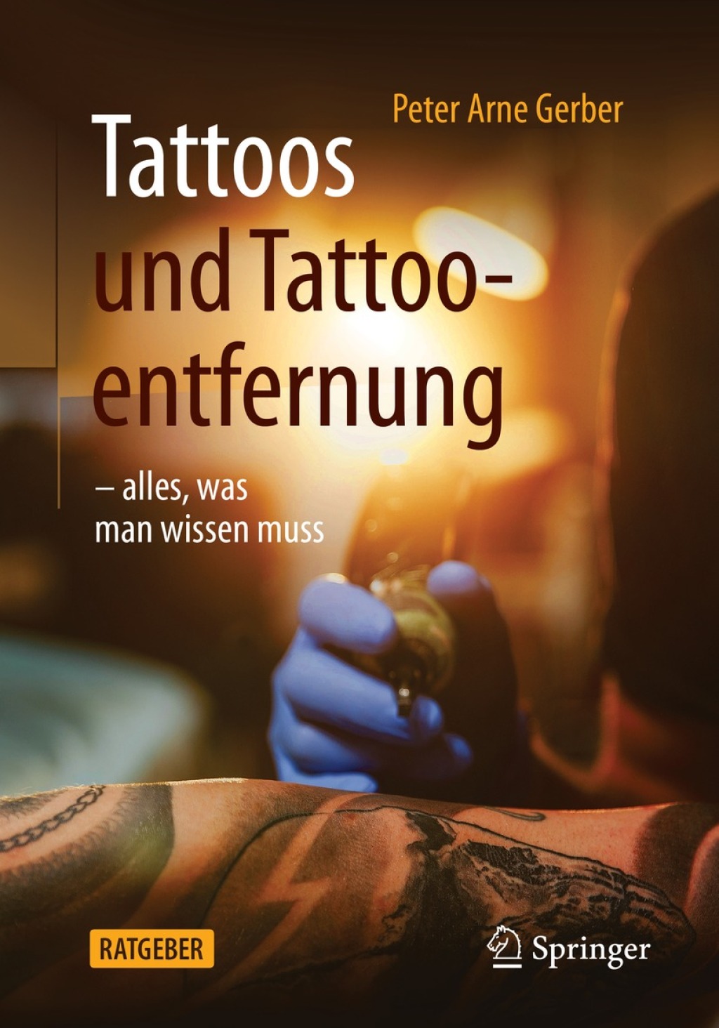 Tattoos und Tattooentfernung -alles, was man wissen muss - (PDF/EPUB Version)
