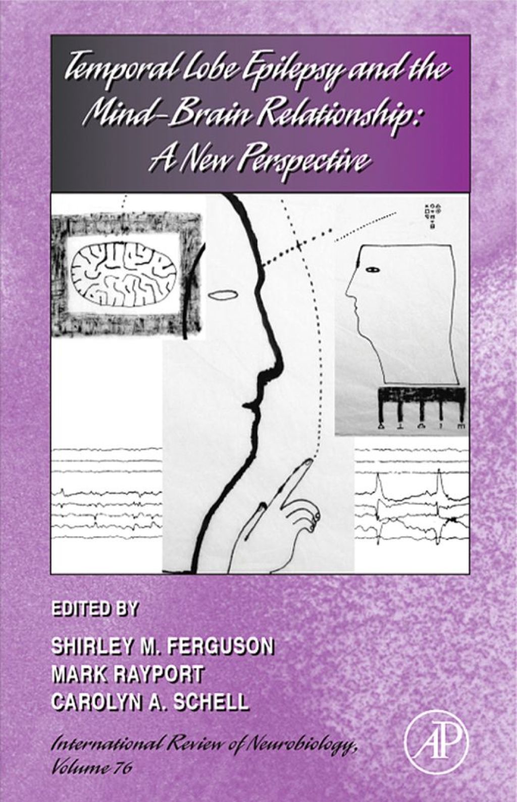 Temporal Lobe Epilepsy and the Mind-Brain Relationship: A New ...