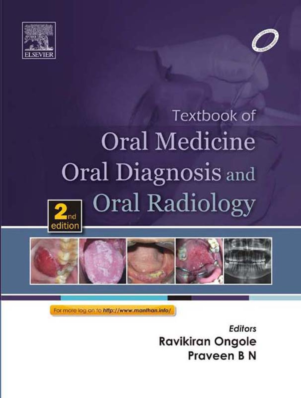 Textbook of Oral Medicine, Oral Diagnosis and Oral Radiology 2nd Edition - (PDF/EPUB Version)