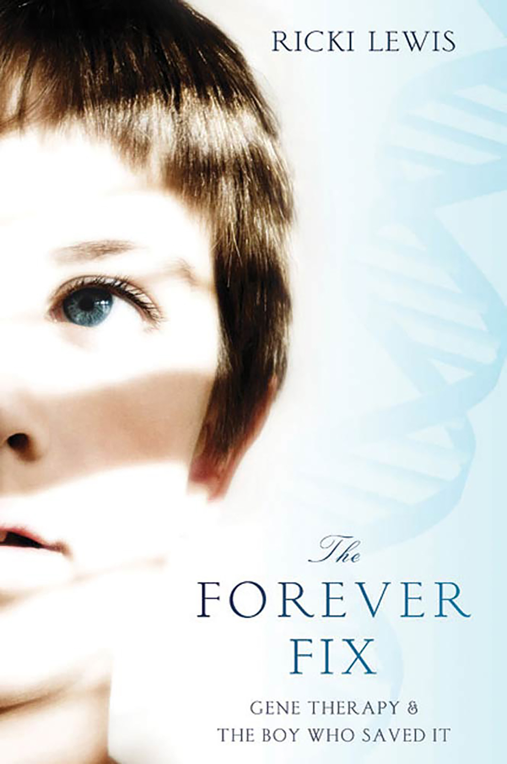 The Forever Fix Gene Therapy and the Boy Who Saved It - (PDF/EPUB Version)