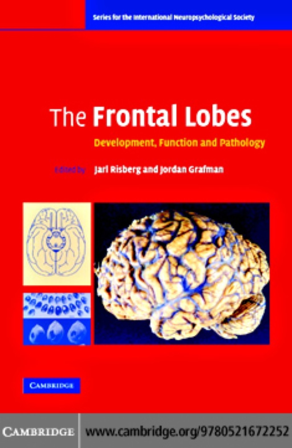 The Frontal Lobes Development, Function and Pathology 1st Edition â ...