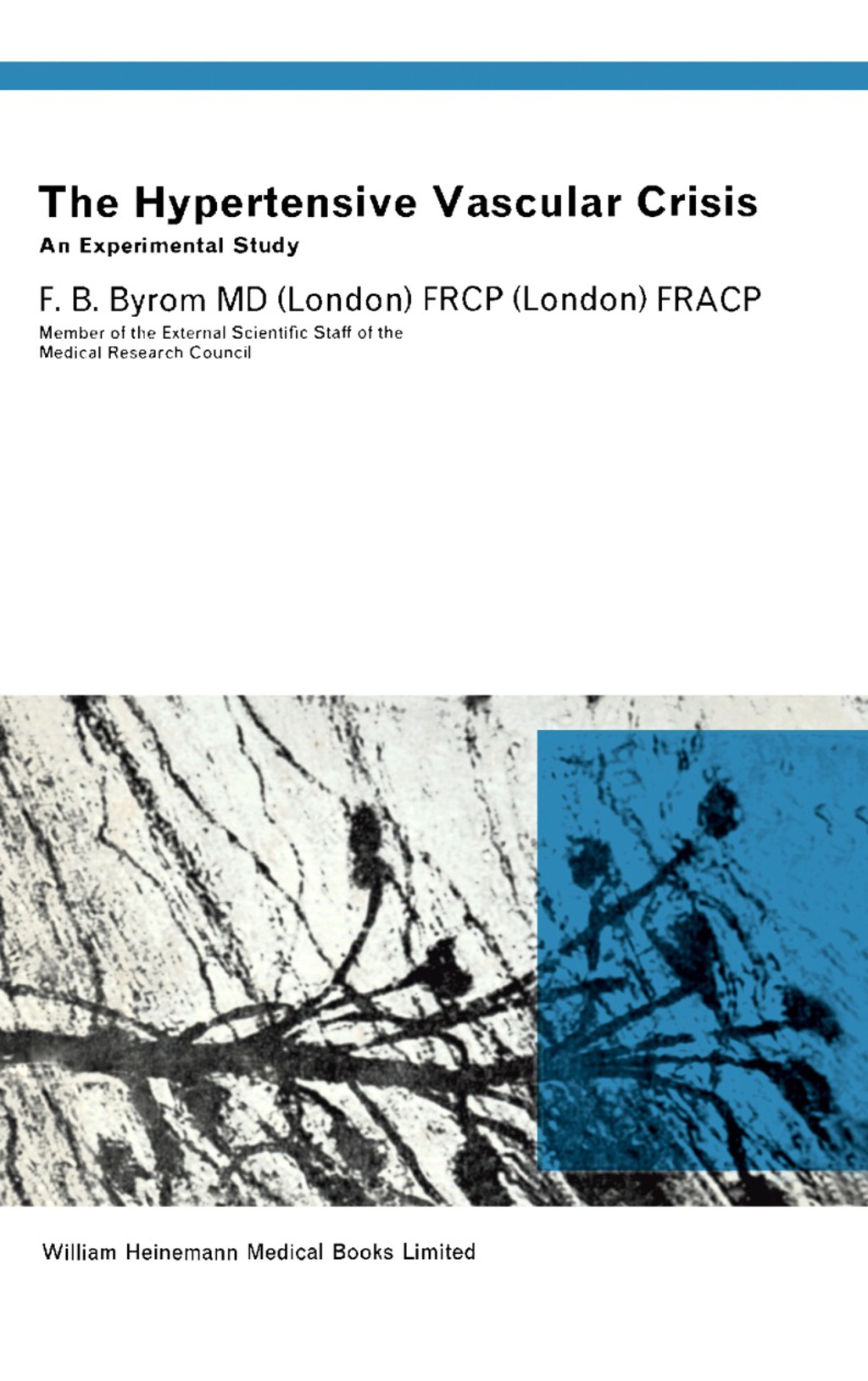 The Hypertensive Vascular Crisis An Experimental Study - (PDF/EPUB Version)
